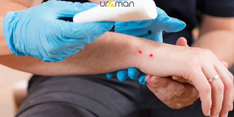 درمان سریع مار گزیدگی