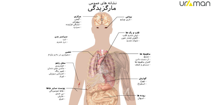 علائم مار گزیدگی
